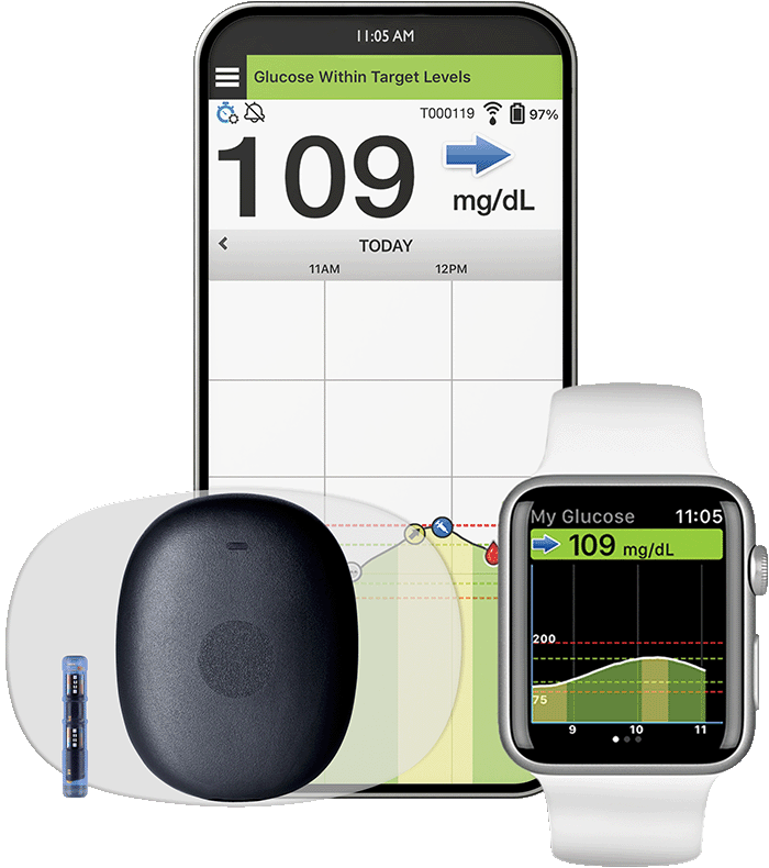 Eversense CGM